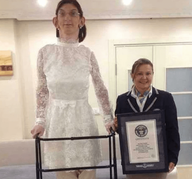 SСамой высокой девушке живется не сладко и это факт