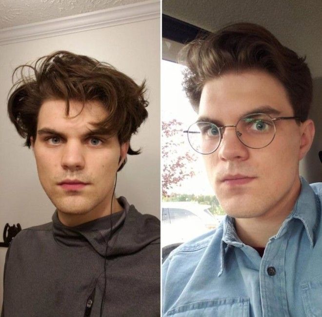 Lюди выставляют фото до и после и тут всё от похудения до исправления зубов