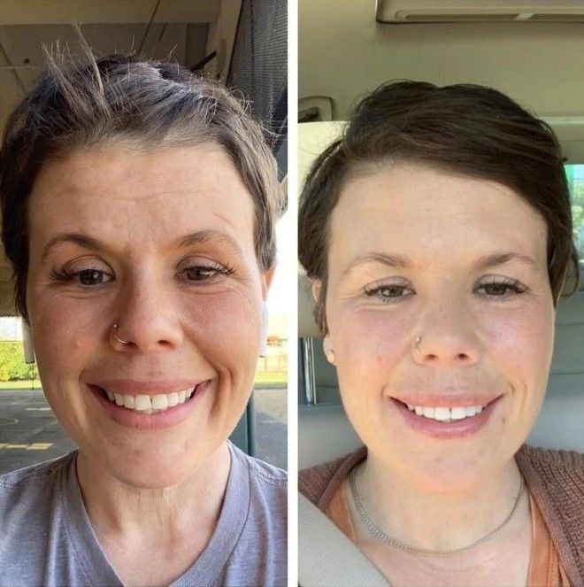 Lюди выставляют фото до и после и тут всё от похудения до исправления зубов