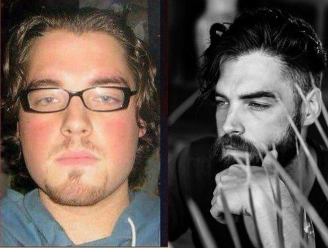 Lюди выставляют фото до и после и тут всё от похудения до исправления зубов