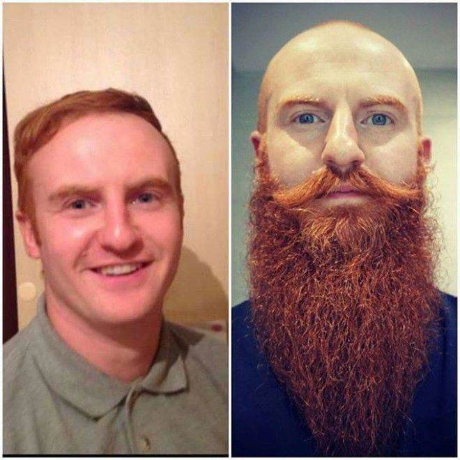 Lюди выставляют фото до и после и тут всё от похудения до исправления зубов