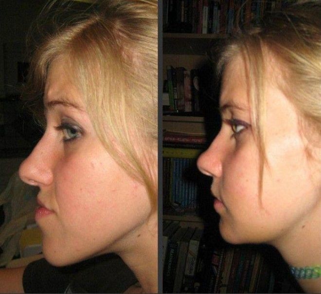 Lюди выставляют фото до и после и тут всё от похудения до исправления зубов