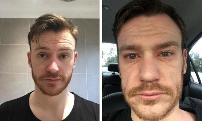 Lюди выставляют фото до и после и тут всё от похудения до исправления зубов