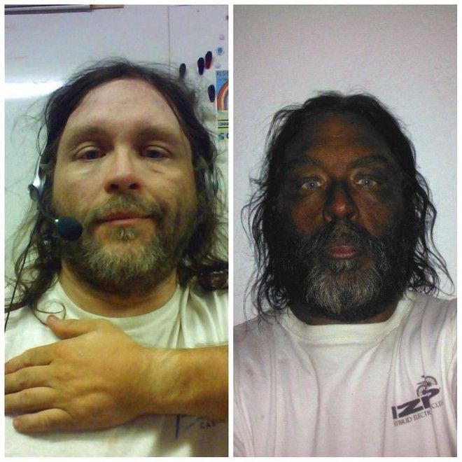 Lюди выставляют фото до и после и тут всё от похудения до исправления зубов