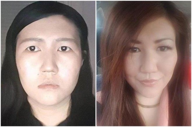 Lюди выставляют фото до и после и тут всё от похудения до исправления зубов