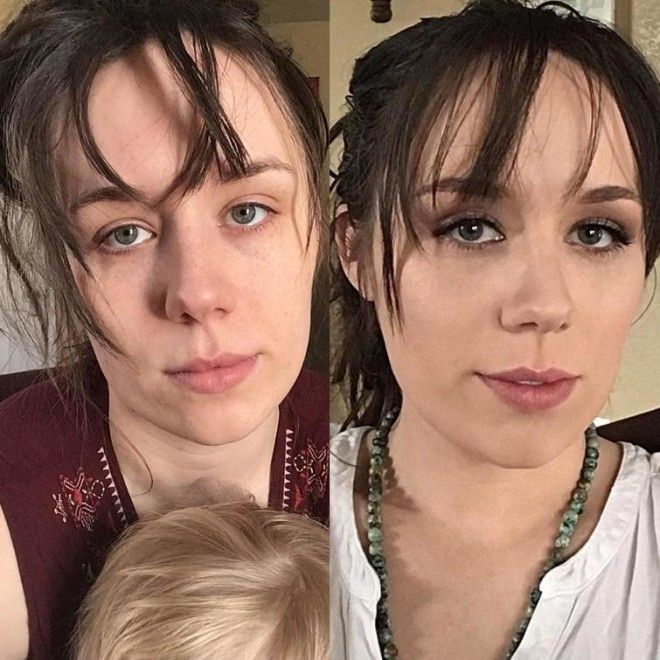 Lюди выставляют фото до и после и тут всё от похудения до исправления зубов