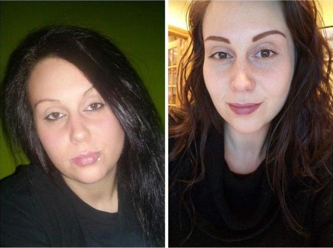 Lюди выставляют фото до и после и тут всё от похудения до исправления зубов