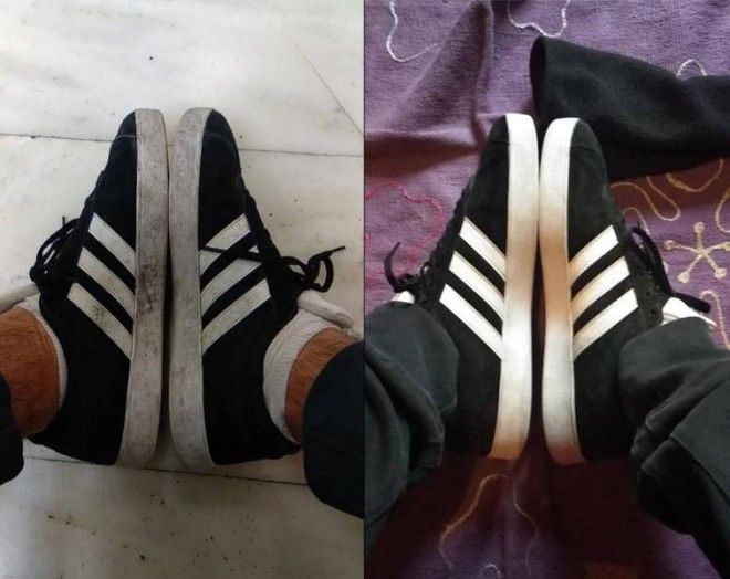 Lюди выставляют фото до и после и тут всё от похудения до исправления зубов