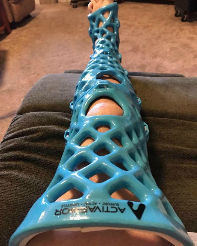 3D гипс Фото Reddit