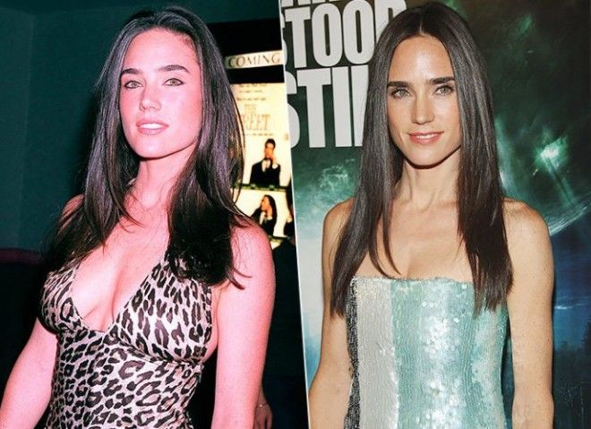 SКому нужны эти надутые шары звезды которые уменьшили грудь и не пожалели