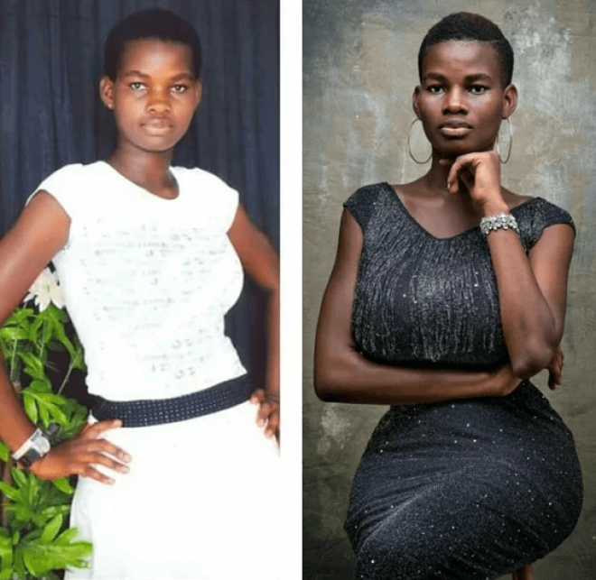 SУ меня не было денег на хирургов Девушка стала моделью благодаря формам