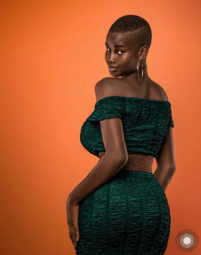 SУ меня не было денег на хирургов Девушка стала моделью благодаря формам