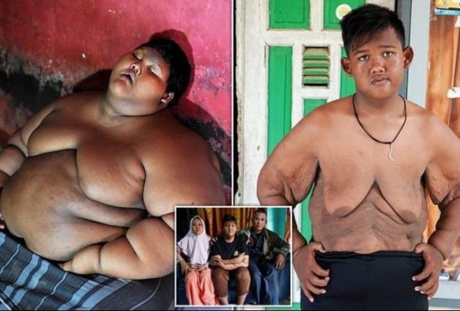 Он весил 192 кг в 10-летнем возрасте, но похудел больше, чем вдвое!